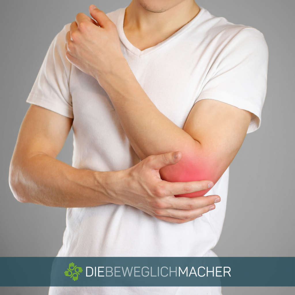 Tennisellenbogen Behandlung - Physiotherapie Köln